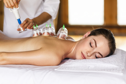 Woman laying on chest with cupping treatment on back